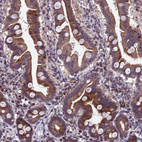 Immunohistochemical staining of human Duodenum shows moderate cytoplasmic positivity in glandular cells.