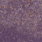 Immunohistochemical staining of human Tonsil shows moderate nuclear and cytoplasmic positivity in germinal and non-germinal center cells.