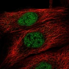 Immunofluorescent staining of human cell line A-431 shows localization to nucleoplasm.