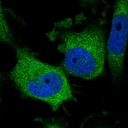 Immunofluorescent staining of human cell line U-251 MG shows positivity in cytoplasm.