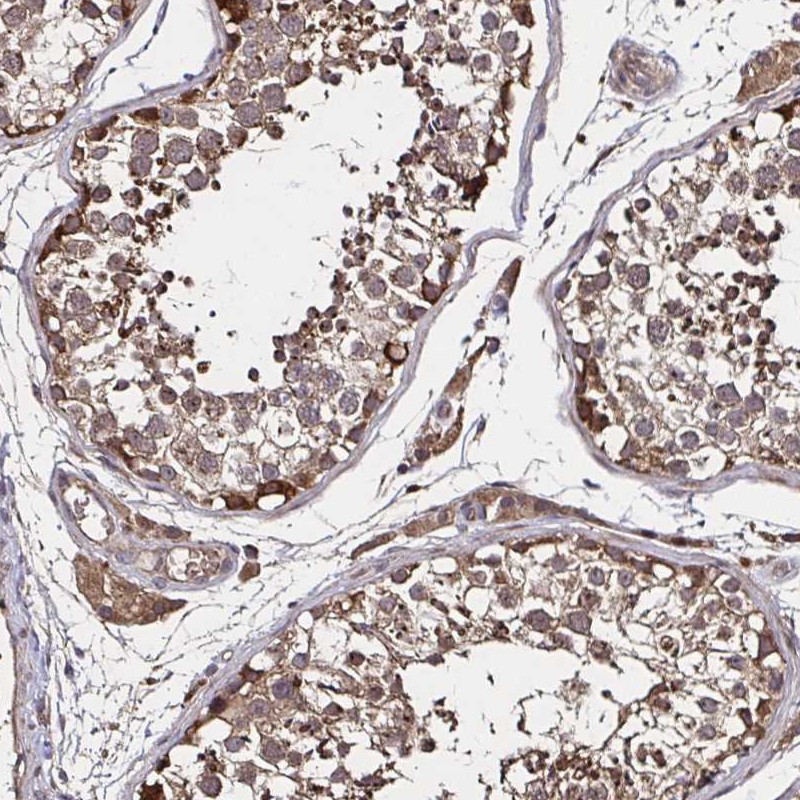 Anti-SMYD3 Antibody
