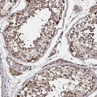 Anti-SMYD3 Antibody
