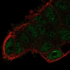 Immunofluorescent staining of human cell line RT4 shows localization to nucleoplasm.