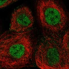 Immunofluorescent staining of human cell line A-431 shows localization to nucleoplasm & cell junctions.