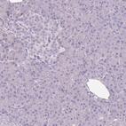 Immunohistochemical staining of human pancreas shows no positivity in exocrine glandular cells as expected.