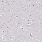 Immunohistochemical staining of human cerebral cortex shows no positivity in neurons as expected.