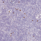 Immunohistochemical staining of human lymph node shows strong cytoplasmic positivity in leukocytes.