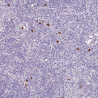 Anti-CD40LG Antibody