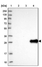 Lane 1: Marker [kDa] 250, 130, 95, 72, 55, 36, 28, 17, 10_br/_Lane 2: Human cell line RT-4_br/_Lane 3: Human cell line U-251MG sp_br/_Lane 4: Human plasma (IgG/HSA depleted)