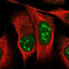 Immunofluorescent staining of human cell line U-2 OS shows localization to nucleus & nucleoli.
