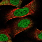 Immunofluorescent staining of human cell line U-2 OS shows localization to nucleoplasm.