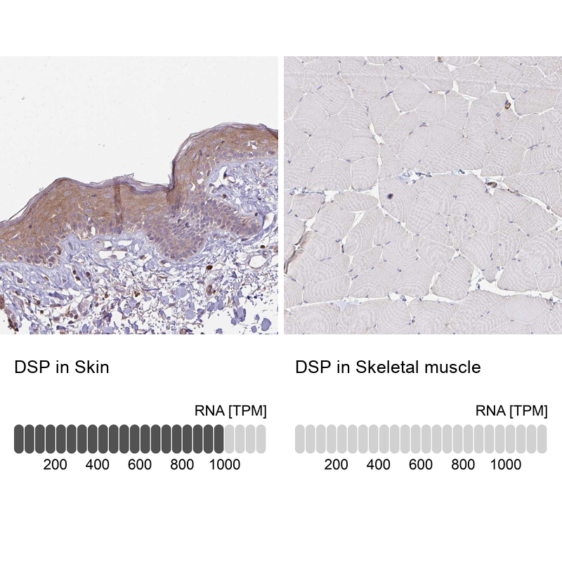 Anti-DSP Antibody
