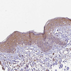 Immunohistochemical staining of human skin shows moderate cytoplasmic positivity in squamous epithelial cells.