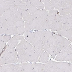 Immunohistochemical staining of human skeletal muscle shows no cytoplasmic positivity in myocytes.