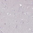 Immunohistochemical staining of human cerebral cortex shows no cytoplasmic positivity in neurons.