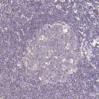 Immunohistochemical staining of human lymph node shows no cytoplasmic positivity in germinal center cells.