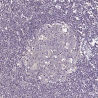 Immunohistochemical staining of human lymph node shows no cytoplasmic positivity in germinal center cells.