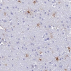 Immunohistochemical staining of human cerebral cortex shows moderate cytoplasmic positivity in a subset of glial cells.