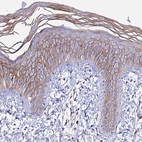 Immunohistochemical staining of human skin shows moderate membranous positivity in squamous epithelial cells.