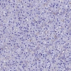 Immunohistochemical staining of human pancreas shows no positivity in exocrine glandular cells as expected.
