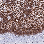 Immunohistochemical staining of human esophagus shows strong membranous positivity in squamous epithelial cells.