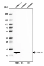 Western blot analysis in SK-BR-3 cells transfected with control siRNA, target specific siRNA probe #1 and #2, using Anti-S100A16 antibody. Remaining relative intensity is presented. Loading control: Anti-GAPDH.