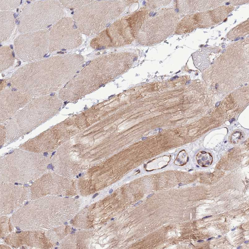 Anti-SLC41A3 Antibody