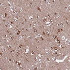 Anti-SLC41A3 Antibody