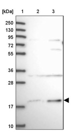 Anti-SLC41A3 Antibody