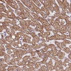 Anti-DCDC2C Antibody