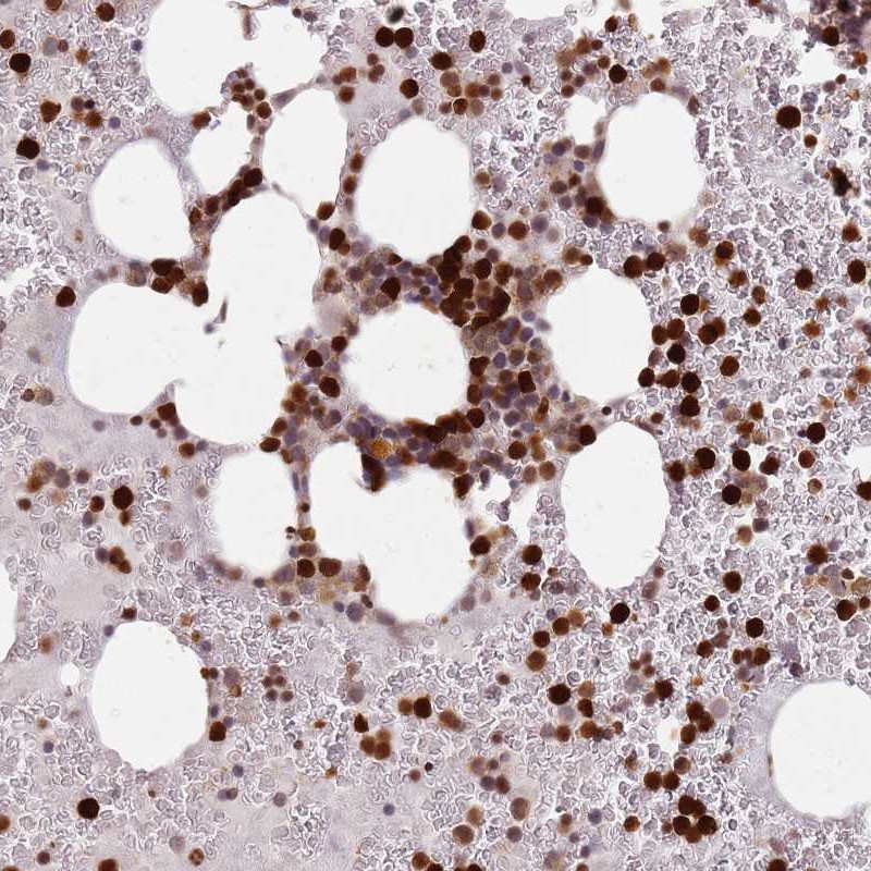 Anti-RESP18 Antibody