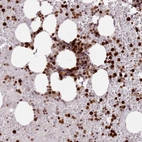 Anti-RESP18 Antibody