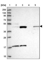 Lane 1: Marker [kDa] 250, 130, 95, 72, 55, 36, 28, 17, 10_br/_Lane 2: Human cell line RT-4_br/_Lane 3: Human cell line U-251MG sp_br/_Lane 4: Human plasma (IgG/HSA depleted)_br/_Lane 5: Human liver tissue