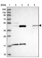 Lane 1: Marker [kDa] 250, 130, 95, 72, 55, 36, 28, 17, 10_br/_Lane 2: Human cell line RT-4_br/_Lane 3: Human cell line U-251MG sp_br/_Lane 4: Human plasma (IgG/HSA depleted)_br/_Lane 5: Human liver tissue