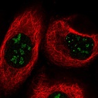 Immunofluorescent staining of human cell line A-431 shows localization to nucleoli.