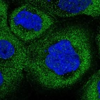 Anti-COLQ Antibody