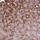 Anti-ZNF530 Antibody