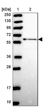 Lane 1: Marker [kDa] 250, 130, 95, 72, 55, 36, 28, 17, 10_br/_Lane 2: Human cell line RT-4