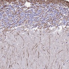 Anti-DLX1 Antibody