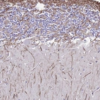 Anti-DLX1 Antibody