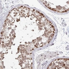 Immunohistochemical staining of human testis shows high expression.