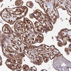 Immunohistochemical staining of human Placenta shows moderate cytoplasmic positivity in trophoblastic cells.