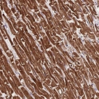 Immunohistochemical staining of human Heart muscle shows strong cytoplasmic positivity in cardiomyocytes.