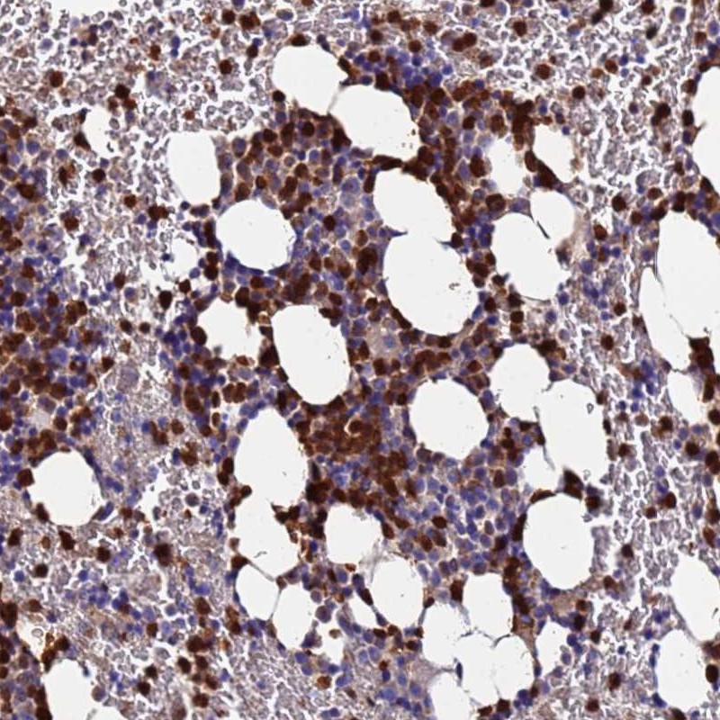 Anti-TUBAL3 Antibody