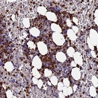 Anti-TUBAL3 Antibody