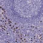 Immunohistochemical staining of human lymph node shows strong nuclear positivity in a subset of non-germinal center cells.