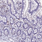 Immunohistochemical staining of human small intestine shows strong positivity in lymphoid cells.