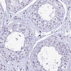 Immunohistochemical staining of human testis shows no positivity in cells in seminiferous ducts as expected.