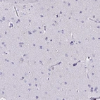 Immunohistochemical staining of human cerebral cortex shows no positivity in neurons as expected.