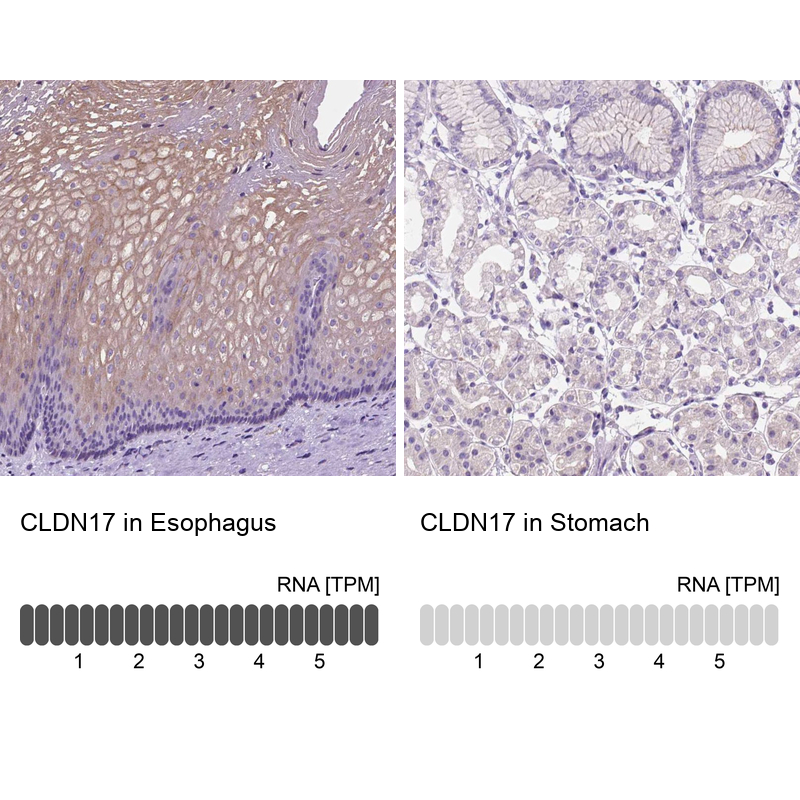 Anti-CLDN17 Antibody